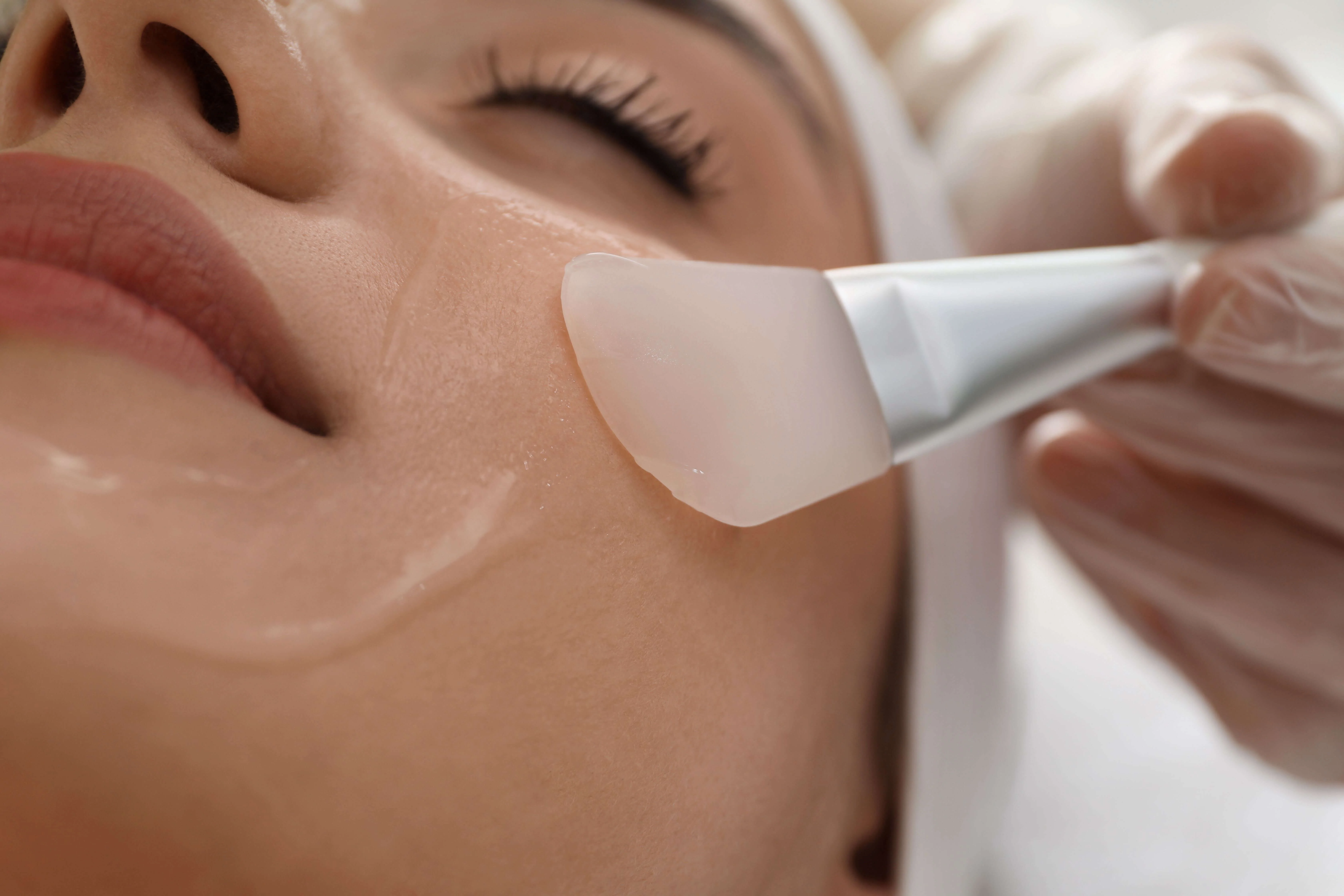 Chemical peel solution being applied to a client's face with a brush